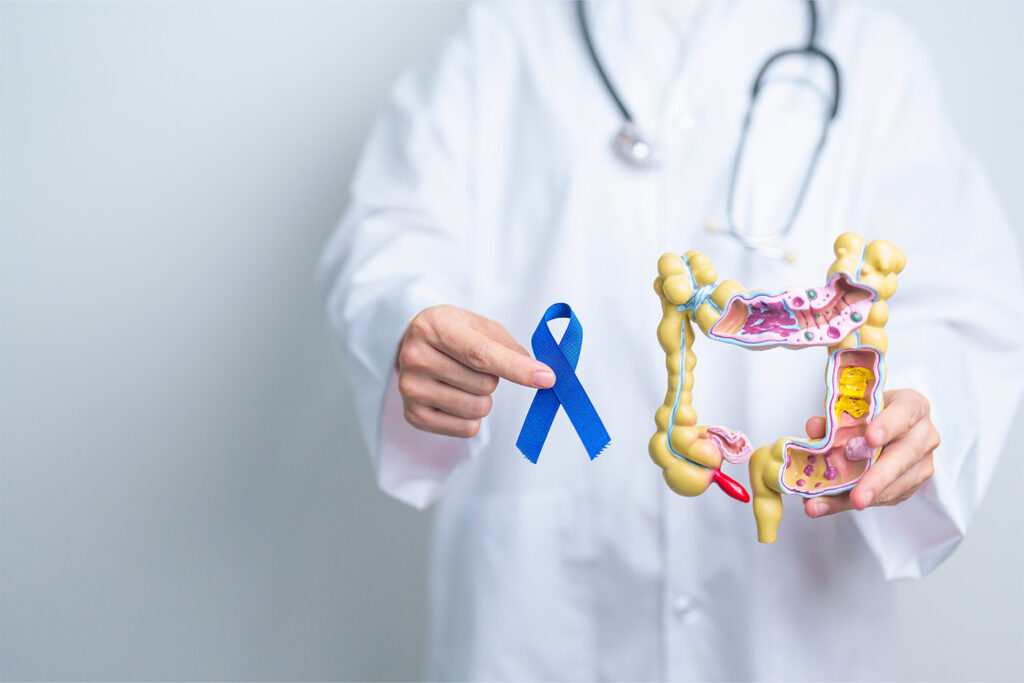 Marzo Azul: Mes de Concientización sobre el Cáncer Colorrectal